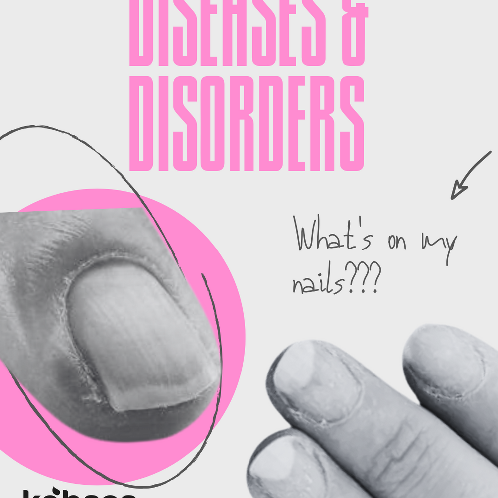 Nail Diseases & Disorders: What causes them and how to spot them